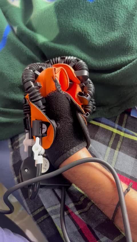 Close-up of a patient's hand inside a robotic hand and finger rehabilitation exoskeleton